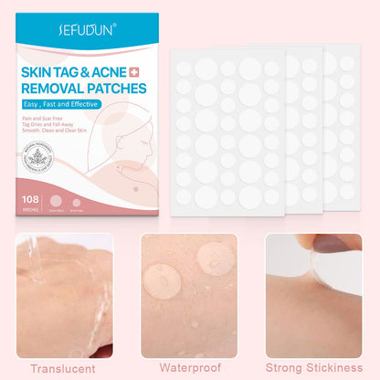 Fast-Acting Acne Patch With Skin Tag Removal