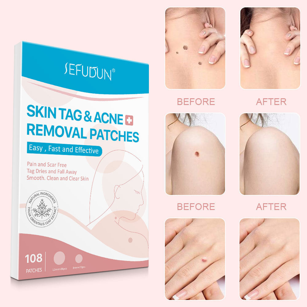Fast-Acting Acne Patch With Skin Tag Removal