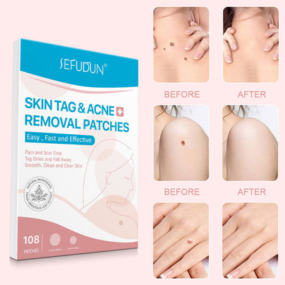 Fast-Acting Acne Patch With Skin Tag Removal